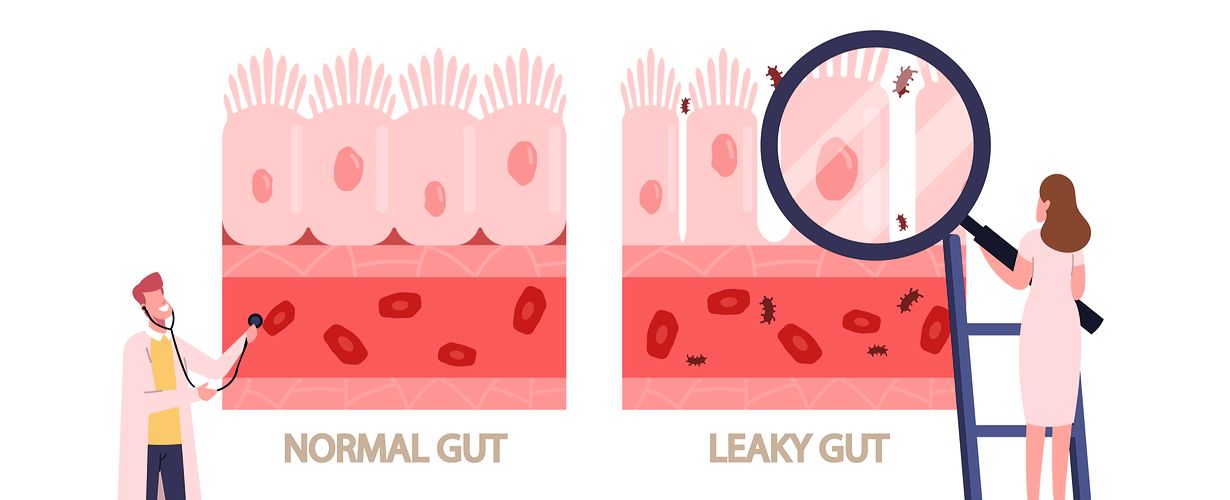 Leaky Gut Syndrome